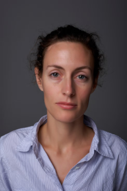 2025 02 10 Cómo tratar las ojeras (2)